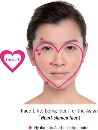 Face Line, being ideal for the Asian