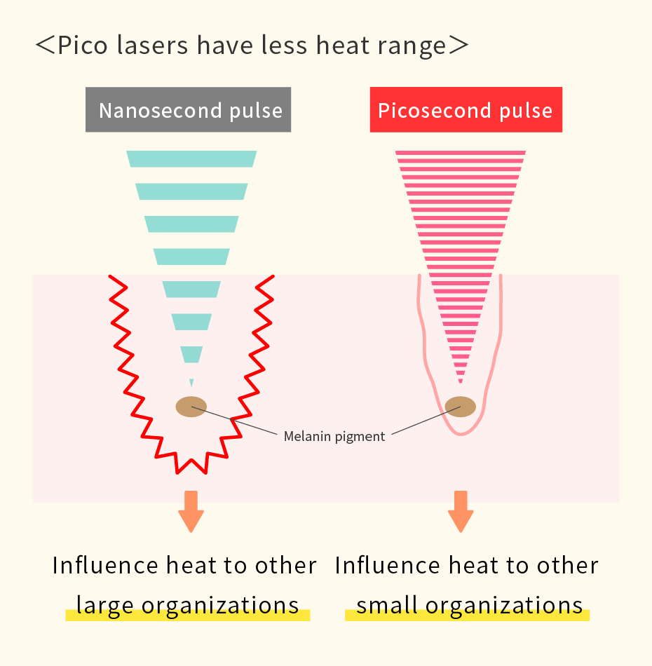 Pico lasers have less heat range