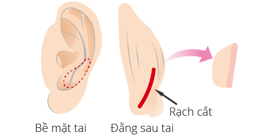 イラスト