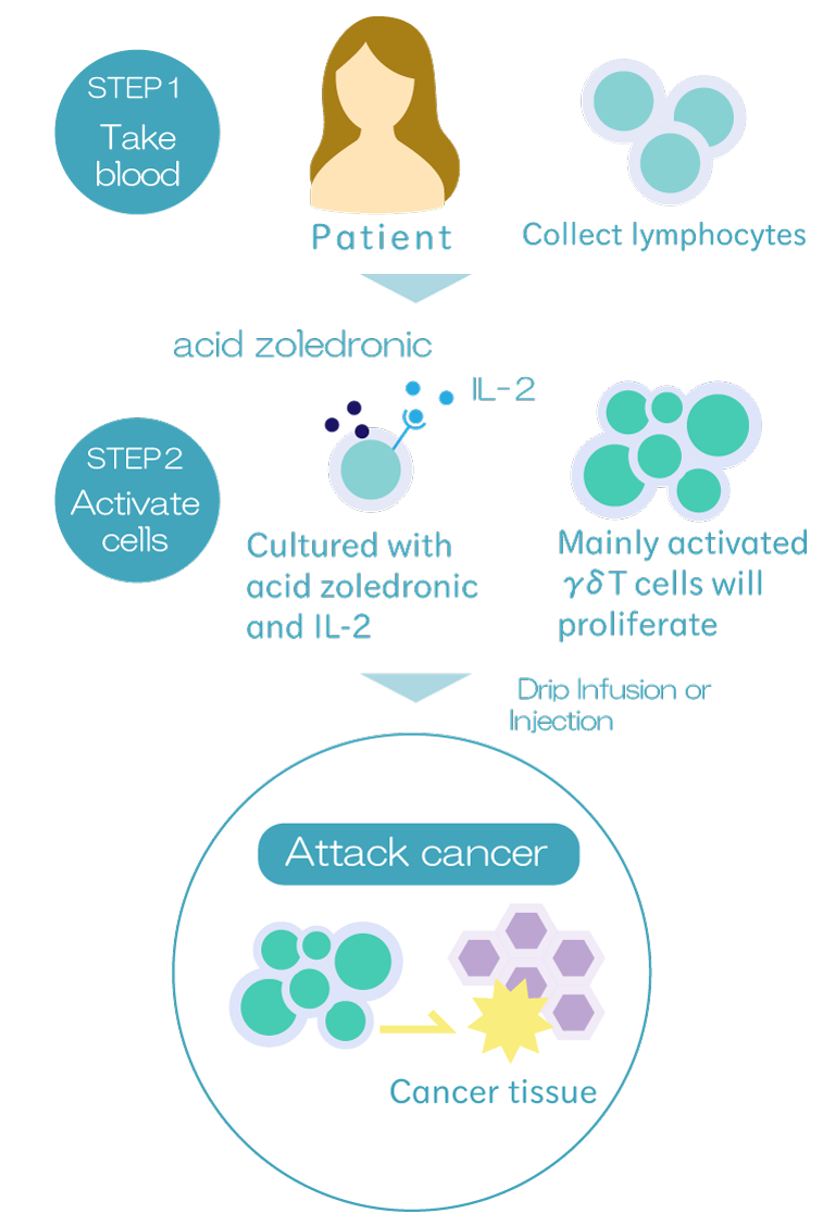 γδT細胞療法イメージ