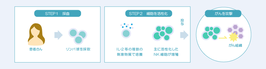NK細胞療法イメージ