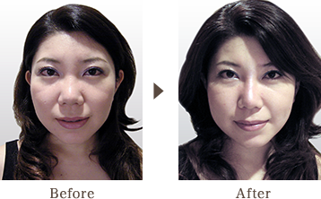 BEFORE / AFTER