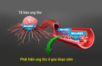 Tế bào ung thư và MicroRNA