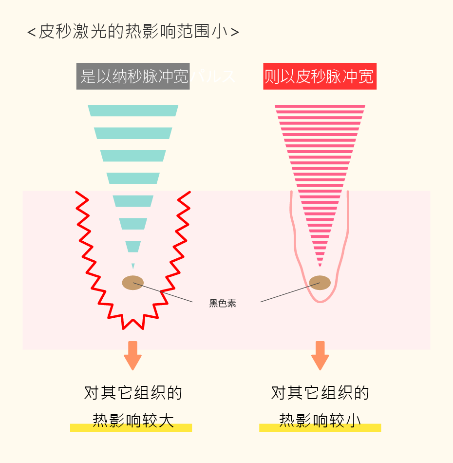 皮秒激光的热影响范围小