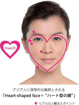 アジア人に理想的な輪郭とされる「Heart-shaped face=ハート型の顔