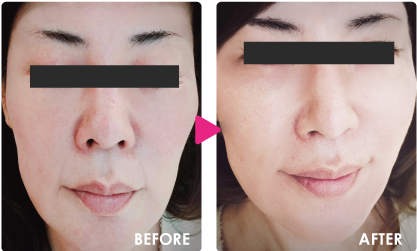 BEFORE / AFTER
